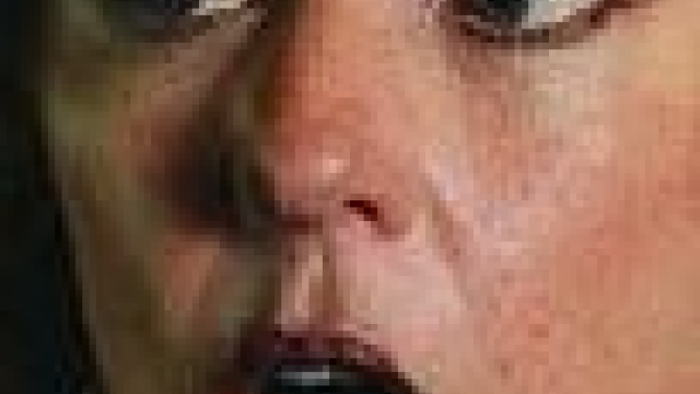 Artikel teaser billede