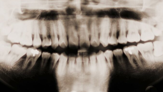 Artikel teaser billede