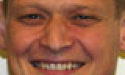 Artikel teaser billede
