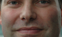 Artikel teaser billede