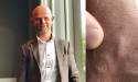 Artikel teaser billede