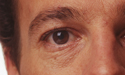 Artikel teaser billede