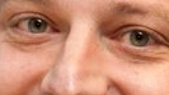 Artikel teaser billede